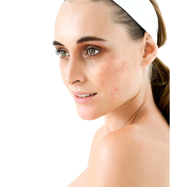 How is Pigmentation Prone Skin different and does it need special daily care?